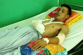 Nhắc nhở... đi tiểu bậy, chủ nhà bị giang hồ chém trọng thương