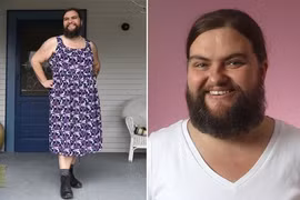 Cô gái tự tin hơn nhờ để râu