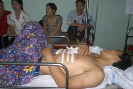 Chủ bị thương vì hai trâu nhà húc nhau