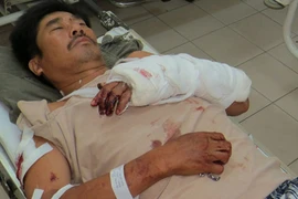 Trạm trưởng bảo vệ rừng bị chém lúc rạng sáng