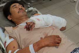 Trạm trưởng bảo vệ rừng bị chém lúc rạng sáng