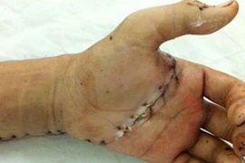 Hãi hùng: Người đàn ông cưa tay, tự sát