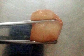 Hà Nội: Hóc vải, bé trai 6 tuổi tử vong thương tâm