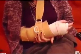 Messi đá gãy cổ tay CĐV của Real Madrid