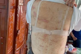 Sắp tới, Chủ tịch xã có quyền đề nghị xử lý hình sự người chồng bạo hành vợ?