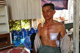 Lái xe ôm giả chết sống sót thần kỳ dưới lưỡi dao 2 tên cướp