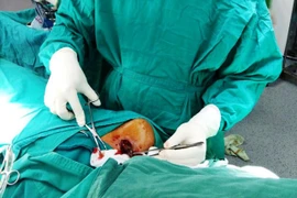 Đồng Nai: Bị cả đoạn gỗ 7cm cắm ngập vai suốt 2 tháng mà không biết