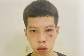 Nhanh chóng bắt giữ đối tượng cướp giật túi xách của cụ bà vừa lĩnh lương hưu