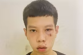 Nhanh chóng bắt giữ đối tượng cướp giật túi xách của cụ bà vừa lĩnh lương hưu