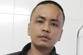 Tạm giam đối tượng chém Công an xã trọng thương