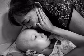 Xúc động người mẹ bán xôi và đứa con nuôi bị ung thư