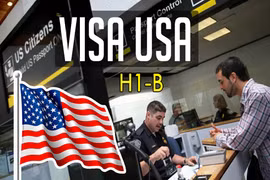 Mỹ lập rào cản với nguồn nhân lực chất lượng cao?