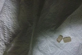 Suýt "hỏng súng" vì tự đeo bi vào dương vật để cải thiện "chuyện ấy"