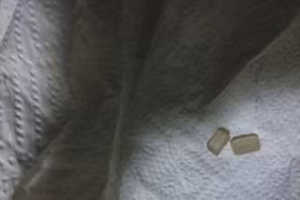 Suýt "hỏng súng" vì tự đeo bi vào dương vật để cải thiện "chuyện ấy"