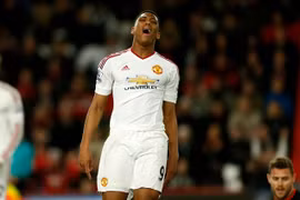 Manchester chia nửa, khi M.U gục ngã trước đối thủ "tí hon"