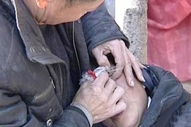 Người phụ nữ Trung Quốc khóc... ra đá to bằng hạt đậu tương