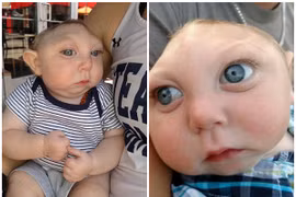 Câu chuyện cổ tích về cậu bé chỉ có nửa hộp sọ