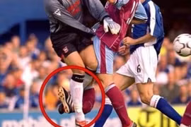 Những chấn thương kinh hoàng gây chấn động thế giới bóng đá