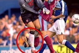 Những chấn thương kinh hoàng gây chấn động thế giới bóng đá