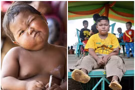 Cậu bé 2 tuổi từng hút 40 điếu thuốc lá/ngày giờ ra sao?