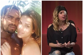 Số phận đau lòng của người đẹp thi hoa hậu bị bạn trai ghen tuông tạt axit