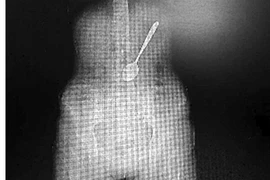 Ăn mỳ, nuốt luôn cả thìa