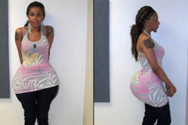 Bắt giữ bác sĩ rởm bơm mông bằng những hợp chất quái dị