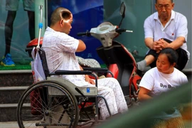 Phi thường người đàn ông sống với lỗ hổng trên đầu