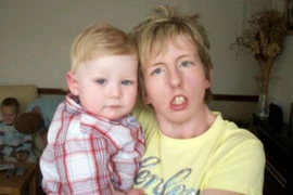 Người phụ nữ không thể cười vì căn bệnh lạ