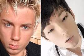 Chàng "Tây" phẫu thuật thẩm mỹ 10 lần để có ngoại hình giống trai Hàn Quốc