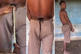 Người đàn ông mọc đuôi như khỉ được phong "thánh” 