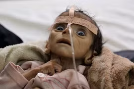 Cái chết ám ảnh của bé trai 5 tháng tuổi tố cáo tội ác chiến tranh