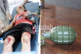 Nổ lựu đạn đồ chơi, hai cháu bé bị thương