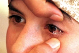 Mắt bé 7 tuổi nhả ra đá