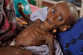 7 tháng tuổi nặng 3,8 kg – sống sót kỳ diệu