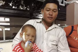 Bé trai 3 tuổi bị cây đâm xuyên mặt được cứu sống kịp thời