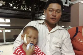 Bé trai 3 tuổi bị cây đâm xuyên mặt được cứu sống kịp thời