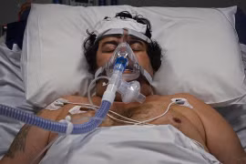 [ẢNH] Cuộc chiến giành giật sự sống với Covid-19 trong bệnh viện ở Sydney