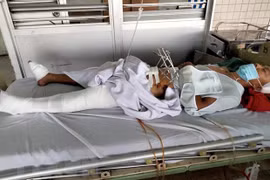 [Tin nhanh tối 10-6-2021] Dũng cảm truy bắt nhóm cướp, một công an xã bị thương nặng