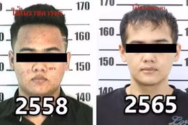 Trùm ma túy nhiều lần phẫu thuật thẩm mỹ cũng không thoát