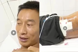 Bị sét đánh 2 lần trong 5 phút, người đàn ông sống sót thần kỳ