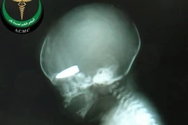 Syria bác tin dùng phụ nữ mang thai làm bia tập bắn