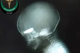 Syria bác tin dùng phụ nữ mang thai làm bia tập bắn