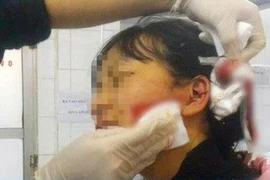 [Tin nhanh sáng 9-3-2022] Một phụ nữ bị rạch mặt khi đi làm giấy tờ ly hôn