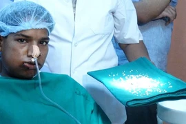 Lạ lùng cậu bé Ấn Độ mắc bệnh "u răng", có tới 232 chiếc răng 