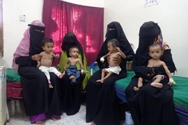 Trẻ em suy dinh dưỡng - hậu quả xung đột “kép” ở Yemen 