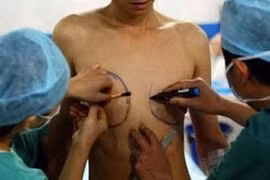 Người chuyển giới có phải xác định lại mã định danh cá nhân?