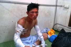 Nổ lớn ở nhà máy chế biến tinh bột sắn, 4 người bị thương nặng