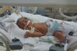 Mổ bắt con thành công cho sản phụ mang thai 28 tuần bị TNGT nguy kịch ​