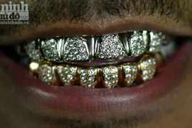 Chiếm đoạt 60 chiếc răng giả "nướng" vào lô đề, cờ bạc